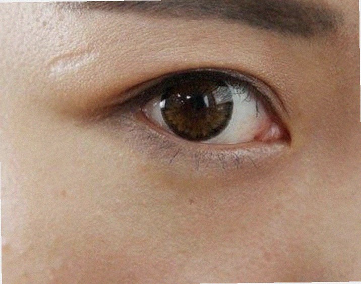 눈위떨림 이상한데 왜 그럴까요