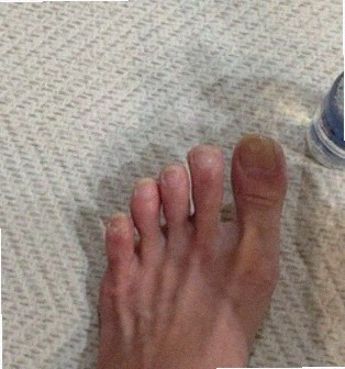 발각질 왜 자꾸 생길까? 계절별 대처와 회복 순서 정리