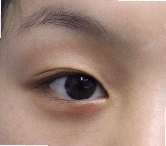 대구안과 추천 좀 해주세요