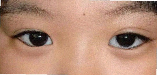 대구안과 추천 좀 해주세요