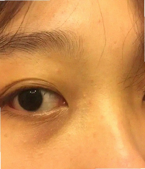 이오스안과 어떤지 궁금해요