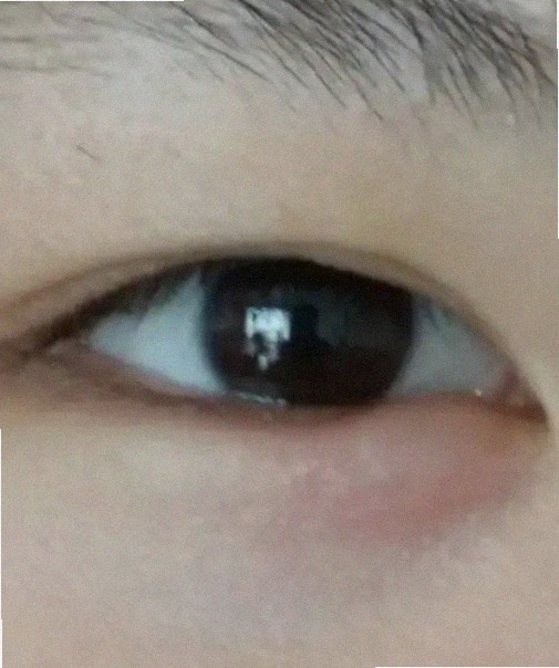 이오스안과 어떤지 궁금해요