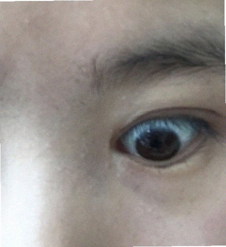 안과의원 어디가 믿을 만한가요