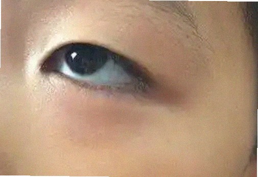변색렌즈 눈에 안 좋은가요;;