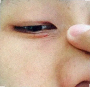 노안안경 언제부터 필요한 건가요