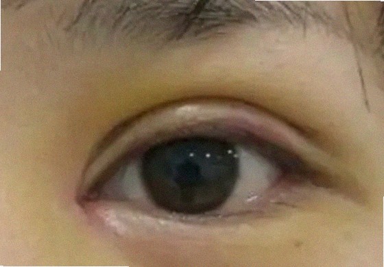 안과의원 어디가 믿을 만한가요
