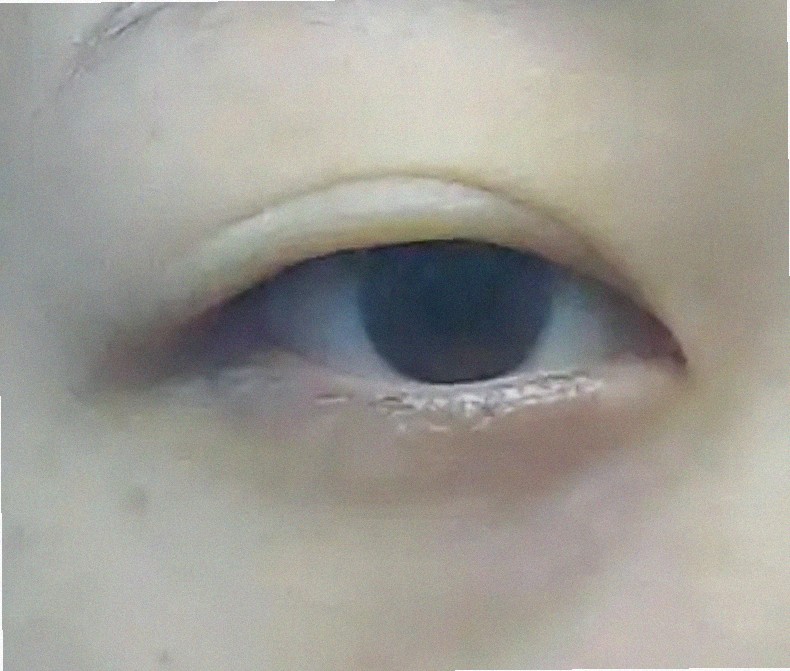 대구안과 추천 좀 해주세요