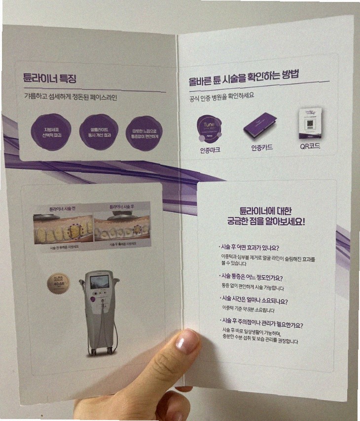 덴서티 비용 얼마나 드는지 궁금해요;;