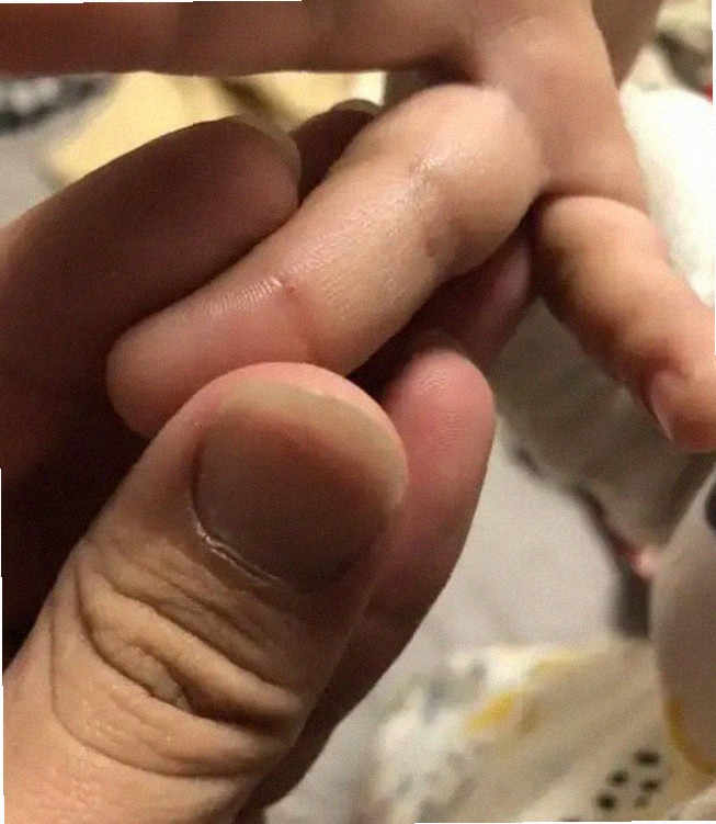 무좀약 피엠 효과 어때요
