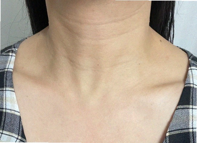포텐자 엑소좀 가격대 어느정도인가요