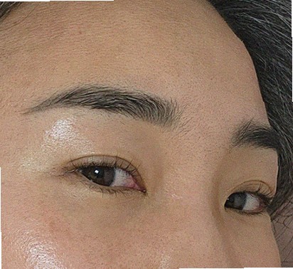 포텐자 붉은기 얼마나 지속되나요