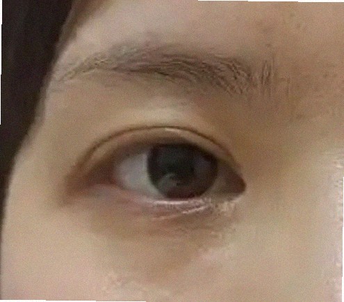 대구안과 추천 어디가 좋을까요