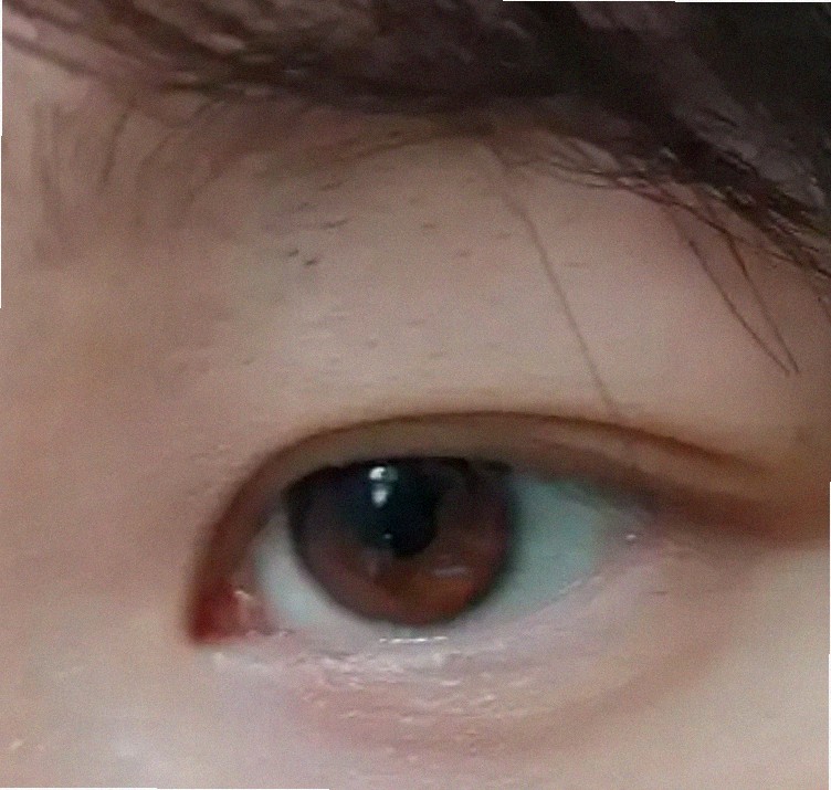 대구안과 추천 어디가 좋을까요