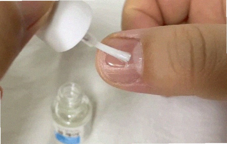 라미실 원스 후기 궁금해요